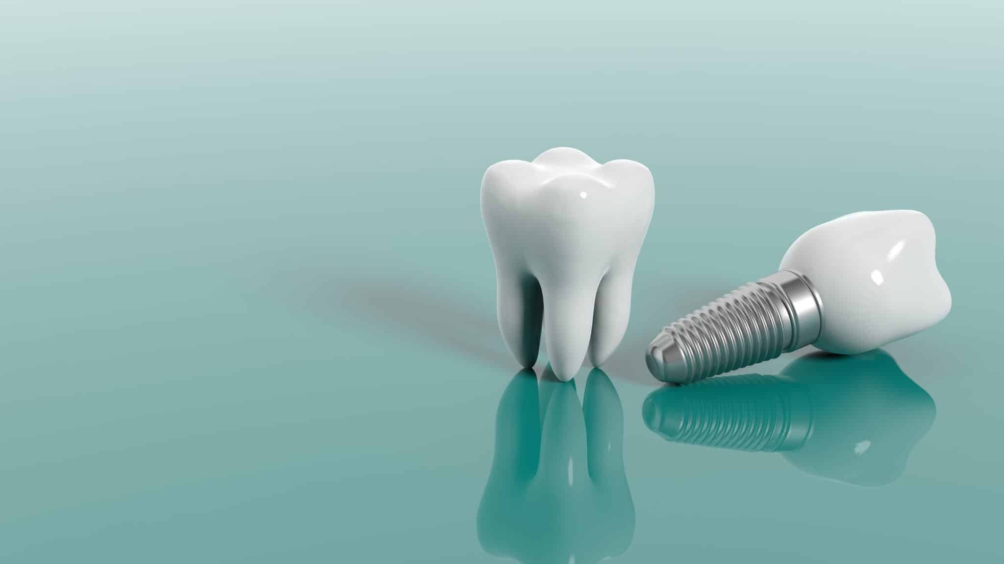Overcoming Dental Anxiety: A Guide for Patients Who Fear the Dentist